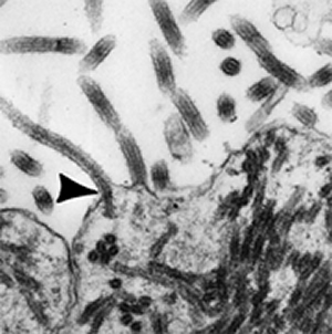Figure 7. Filamentous Forms of the Ebola. Magnification: approximately x40,000. Micrograph from F. A. Murphy, University of Texas Medical Branch, Galveston, Texas. 