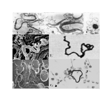 Figures 5A through 5G. Which of the serpentine, worm-like forms above is the Ebola virus?The correct answer is Figure 5 F. Figures 5A,5B and 5C are L-Forms (Or Cell-Wall-Deficient Forms) of TB Under theElectron Microscope. (Michailova, L et al. Morphological variability and cell wall deficiency in ‘heteroresistant’ strains. Internat Journ of Tuberc and Lung Dis, 9:,8, Aug 2005:.907-914:,911). Figure 5D. Worm-like lethal tubercular cords from an atypical TB under the Electron Microscope. (Julián E, Roldán, M Journ. Of Bact Apr. 2010 p.1751-1760. P.1756). Such virulent cords are also represented in Figure 5E (Darzins, E. The Bacteriology of Tuberculosis Minneapolis. 1958. 488pps. p296) and Figure 5G. 