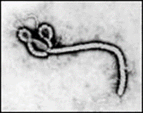 Figure 4. The Serpentine Form of the Ebola Virus. Magnification: approximately x60,000. Micrograph from F. A. Murphy, University of Texas Medical Branch, Galveston, Texas. Courtesy: CDC Dr. Frederick A. Murphy 